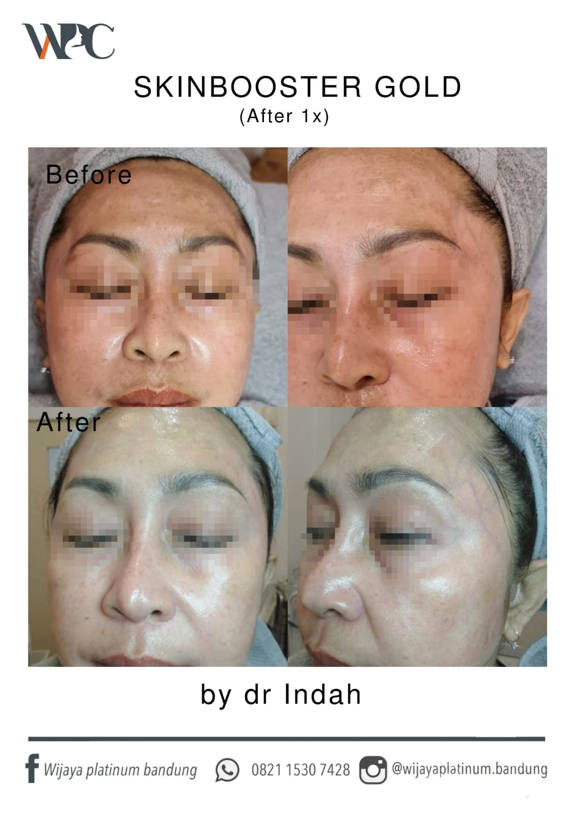 Detail Service SKINBOOSTER WHITENING